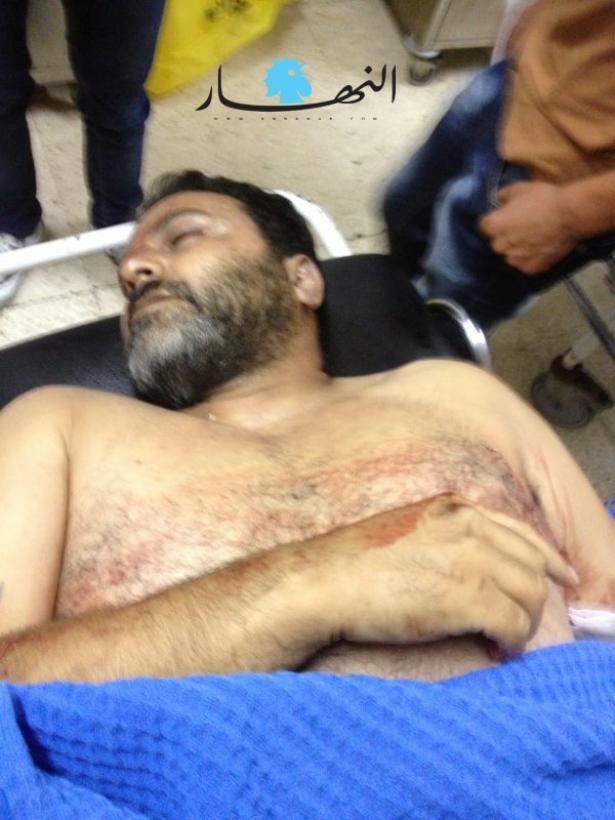 المواطن محمد عبس أصيب في باب التبانة خلال اطلاق نار ابتهاجاً بتفجير الضاحية